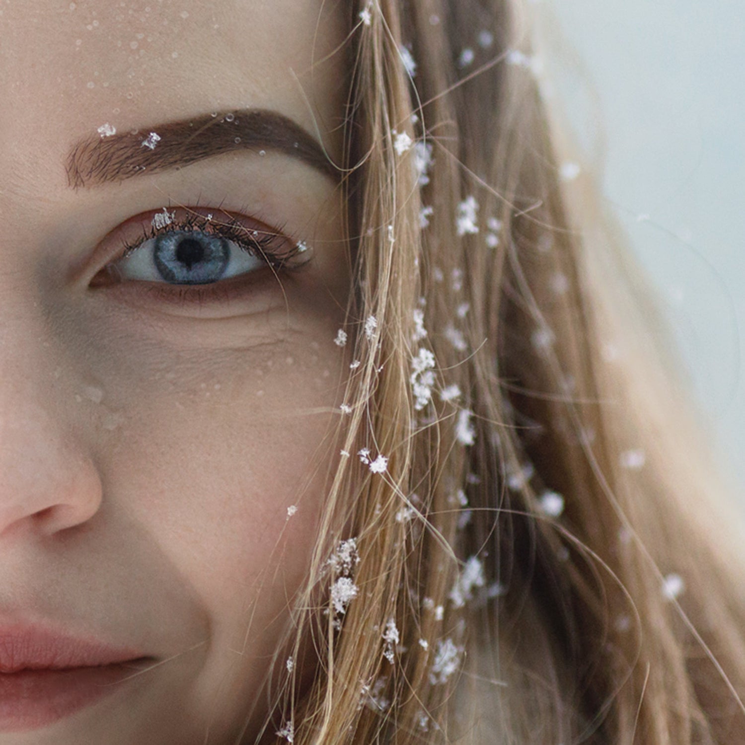 Dandruff - Can you help?